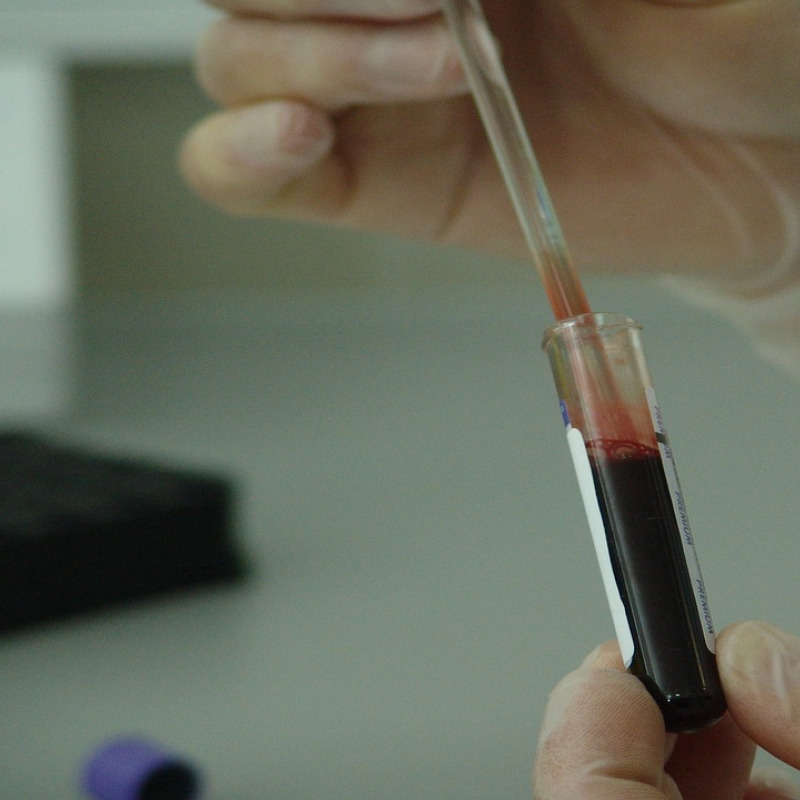 laboratory equipment pipette